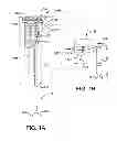 Fig. 02 - Controlled deployable medical device and method of making the same