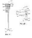 Fig. 05 - Controlled deployable medical device and method of making the same