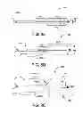 Fig. 11 - Controlled deployable medical device and method of making the same