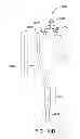 Fig. 15 - Controlled deployable medical device and method of making the same
