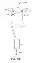 Fig. 17 - Controlled deployable medical device and method of making the same