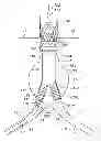 Fig. 01 - GATE WIRE FOR CONTRALATERAL LEG ACCESS