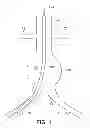 Fig. 02 - GATE WIRE FOR CONTRALATERAL LEG ACCESS