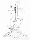 Fig. 03 - GATE WIRE FOR CONTRALATERAL LEG ACCESS