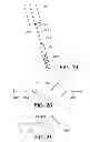 Fig. 13 - GATE WIRE FOR CONTRALATERAL LEG ACCESS