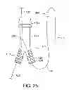 Fig. 16 - GATE WIRE FOR CONTRALATERAL LEG ACCESS