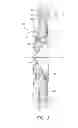 Fig. 05 - Devices and methods for coronary sinus pressure relief