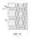 Fig. 09 - Devices and methods for coronary sinus pressure relief