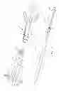 Fig. 12 - Devices and methods for coronary sinus pressure relief