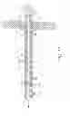 Fig. 17 - Devices and methods for coronary sinus pressure relief