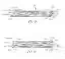 Fig. 22 - Devices and methods for coronary sinus pressure relief