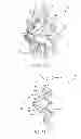 Fig. 23 - Devices and methods for coronary sinus pressure relief