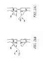 Fig. 29 - Devices and methods for coronary sinus pressure relief