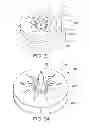 Fig. 34 - Devices and methods for coronary sinus pressure relief