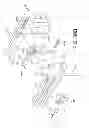 Fig. 38 - Devices and methods for coronary sinus pressure relief