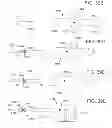 Fig. 40 - Devices and methods for coronary sinus pressure relief