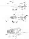 Fig. 42 - Devices and methods for coronary sinus pressure relief