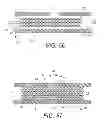 Fig. 51 - Devices and methods for coronary sinus pressure relief