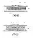 Fig. 52 - Devices and methods for coronary sinus pressure relief