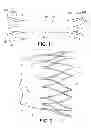 Fig. 02 - SAC LINER FOR ANEURYSM REPAIR