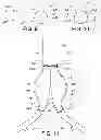 Fig. 05 - SAC LINER FOR ANEURYSM REPAIR