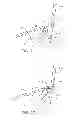 Fig. 04 - Devices and methods for heart valve repair