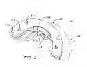 Fig. 06 - Devices and methods for heart valve repair