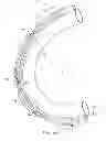 Fig. 13 - Devices and methods for heart valve repair