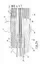 Fig. 04 - Methods and apparatuses for deploying minimally-invasive heart valves