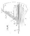 Fig. 05 - Methods and apparatuses for deploying minimally-invasive heart valves