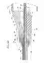 Fig. 10 - Methods and apparatuses for deploying minimally-invasive heart valves