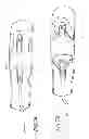 Fig. 11 - Methods and apparatuses for deploying minimally-invasive heart valves