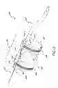 Fig. 20 - Methods and apparatuses for deploying minimally-invasive heart valves