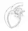 Fig. 01 - Transcatheter heart valves