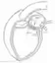 Fig. 01 - Transcatheter heart valves
