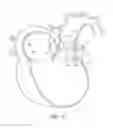 Fig. 14 - Transcatheter heart valves
