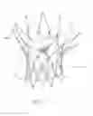 Fig. 17 - Transcatheter heart valves