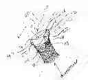 Fig. 01 - Reinforced commissural support structure