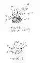 Fig. 02 - Reinforced commissural support structure