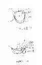 Fig. 03 - Reinforced commissural support structure