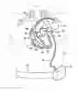 Fig. 01 - System and method for assisted partitioning of body conduits