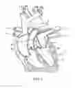 Fig. 02 - System and method for assisted partitioning of body conduits