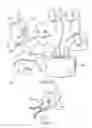 Fig. 08 - System and method for assisted partitioning of body conduits