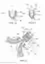 Fig. 09 - System and method for assisted partitioning of body conduits