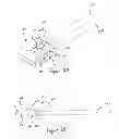 Fig. 06 - Stable device for intervertebral distraction and fusion