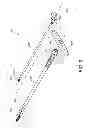 Fig. 03 - Percutaneous arthrodesis method and system