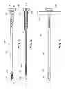 Fig. 04 - Percutaneous arthrodesis method and system