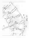 Fig. 08 - Percutaneous arthrodesis method and system