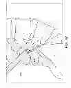 Fig. 28 - Percutaneous arthrodesis method and system