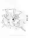 Fig. 30 - Percutaneous arthrodesis method and system